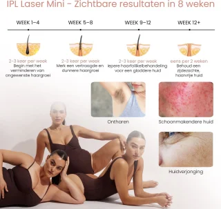 Skinalis IPL Laser Mini Lichtontharingsapparaat