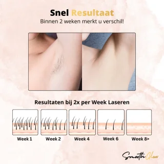 SmoothGlow IPL Laser Ontharingsapparaat Pro
