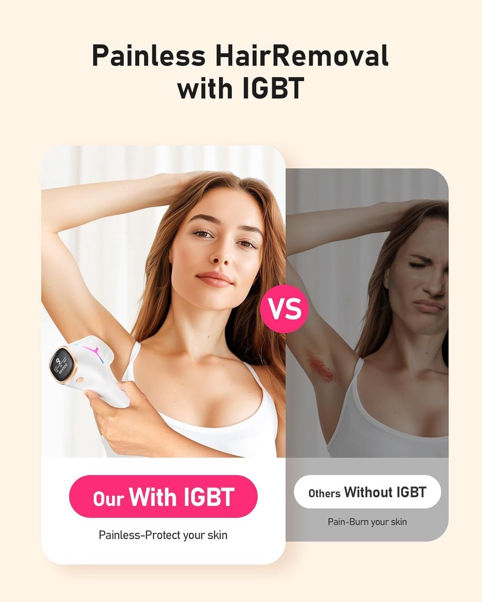 Sumer IPL Ontharingsapparaat 999.999 Flitsen
