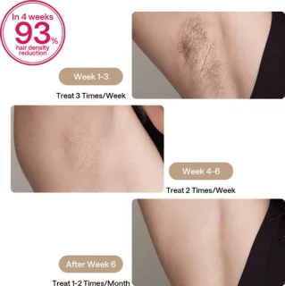 Ulike Air 2 & Hair Removal Cream Bundle