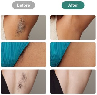 Wat vinden we goed aan de Ulike Air 2 & Hair Removal Cream Bundle