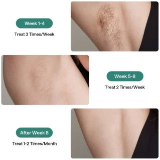 Ulike Air 2 & Hair Removal Cream Bundle