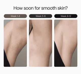 Ulike Bundle: Air 3 Pink & Hair Removal Cream