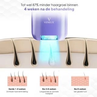 Veneux Laser Ontharingsapparaat