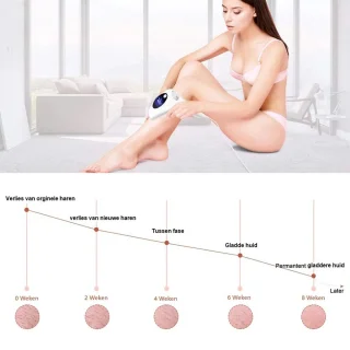 XANAA IPL Ontharingsapparaat