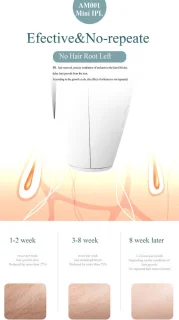 Wat vinden we goed aan de XF800 IPL Ontharingsapparaat