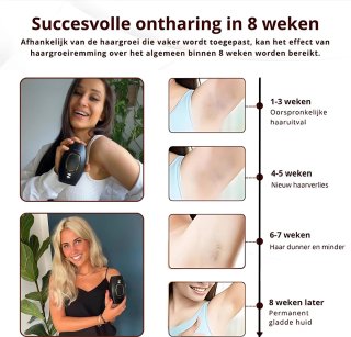 Wat vinden we goed aan de Zeri IPL Ontharingsapparaat