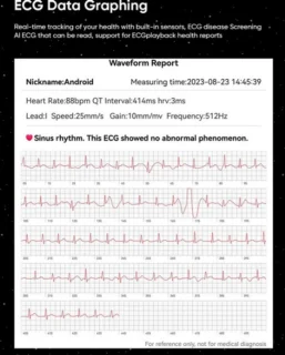 2025 Bloedsuiker Smart Watch Niet-Invasieve Bloedglucose Hartslag Gezondheid Monitor Pijnloos Meten Sport Smartwatch Insuline Meten AI Technologie Zilveren band + Extra Witte Ledere Band
