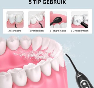 Wat vinden we minder goed