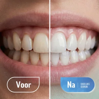 Wat vinden we minder goed