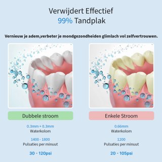 Wat vinden we goed aan de GoGoldPro Monddouche - Waterflosser