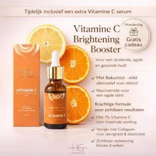 Wat vinden we minder goed