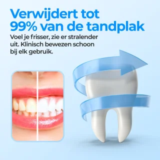 Inventex Waterflosser Elektrisch Reisformaat Zwart