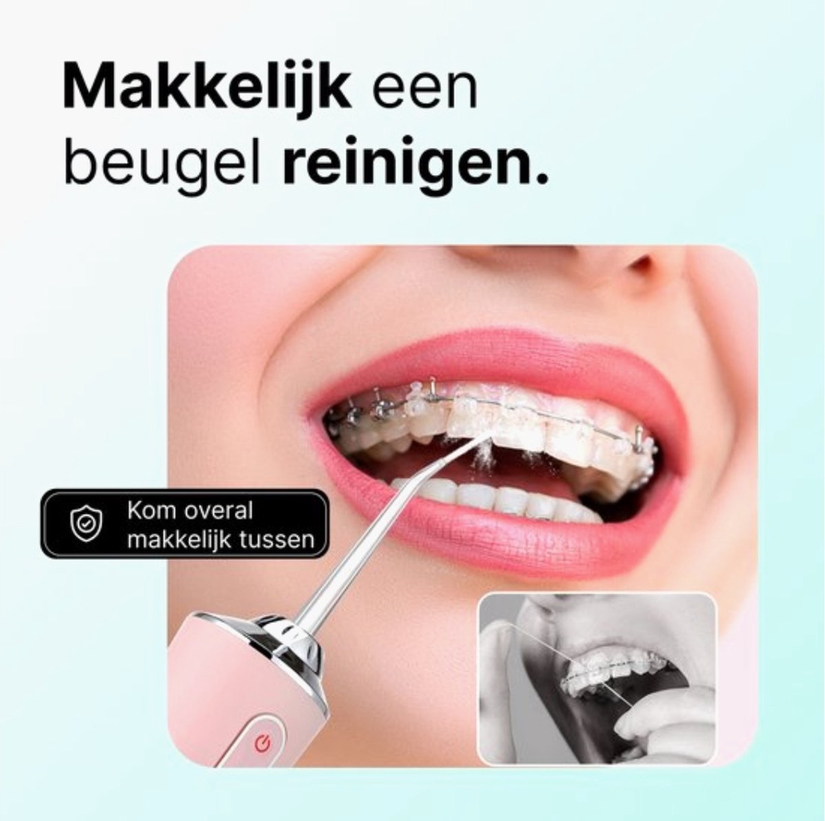 Advies voor kopers