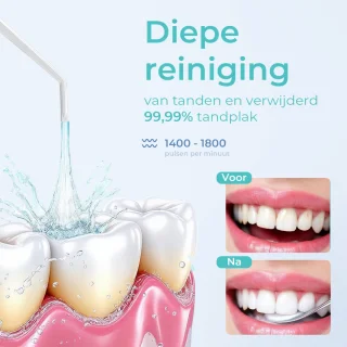 Mondura Waterflosser Draadloos Zwart