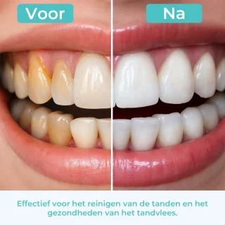 Mondura Waterflosser Draadloos Zwart
