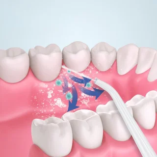 Oral Irrigator Waterflosser Draadloos Groen