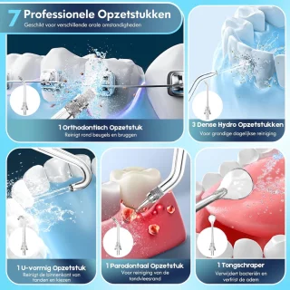 Wat vinden we goed aan de SNJY® Waterflosser Monddouche Flosapparaat 300 ml Blauw