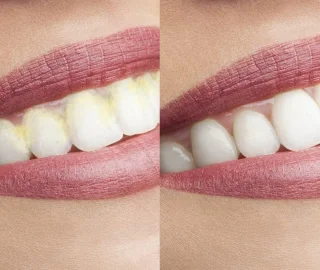 Vitalmaxx Flosapparaat Blauw