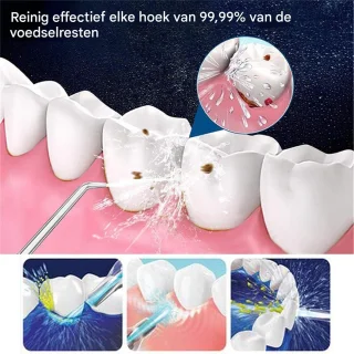 Vitdipy Draadloze Waterflosser