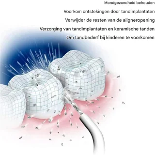 Vitdipy Draadloze Waterflosser