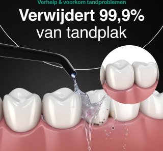 Vivid Green Waterflosser Elektrisch Zwart