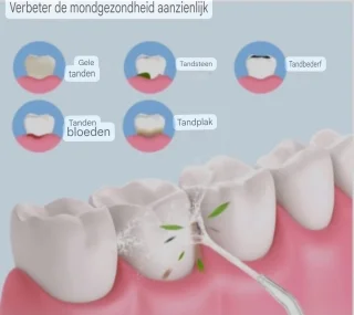 Waterflosser Monddouche 4 Opzetstukken Lichtroze USB Oplaadbaar