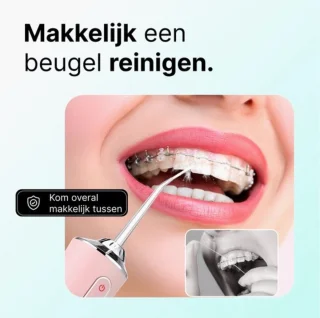Advies voor kopers