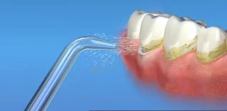 Waterpik JT-100 Jet Tips 2-pack Zilver