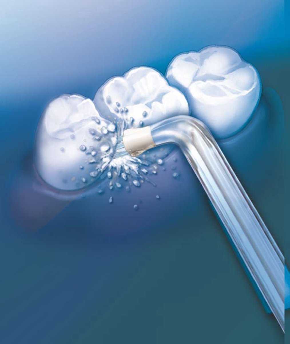 Wat vinden we goed aan de Waterpik Plaque Seeker PS100 opzettip voor WP100-WP660