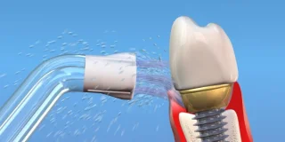 Waterpik Plaque Seeker PS100 opzettip voor WP100-WP660