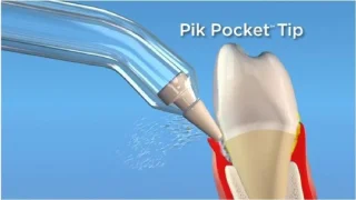 Waterpik PP-100 Pik-Pocket Opzetstukken 2 stuks Zilver