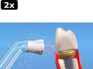 Waterpik PS-100E Plaque Seeker opzetstukken - 2 stuks review