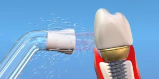 Waterpik PS-100E Plaque Seeker Opzetstukken 2 stuks zilver