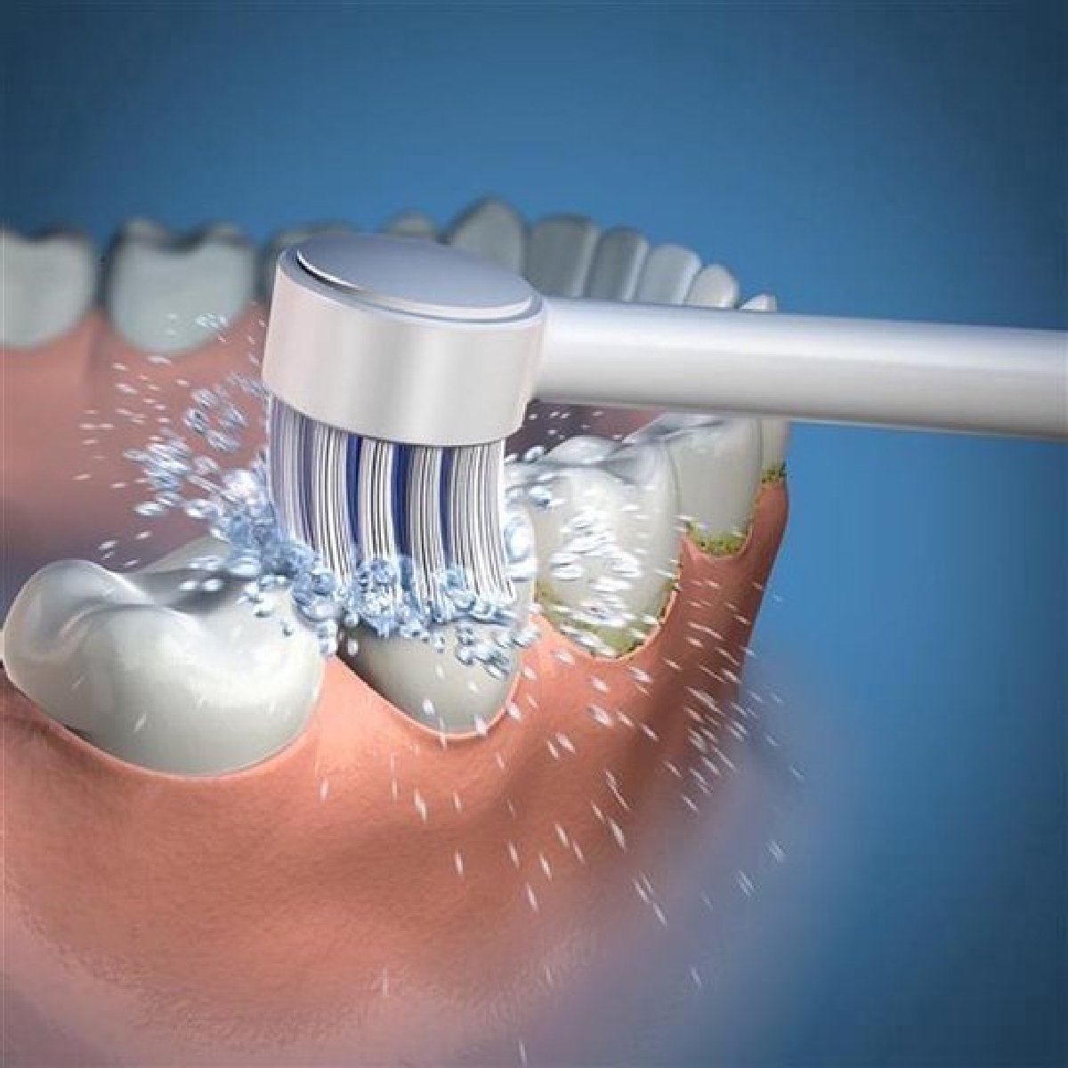 Wat vinden we goed aan de Waterpik TB-100E Tips 2 Stuks