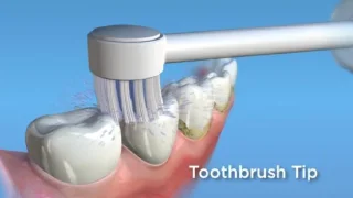 Waterpik TB-100E Tips 2 Stuks