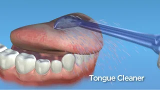 Waterpik Tongreiniger Tips TC-100 - 2 Stuks