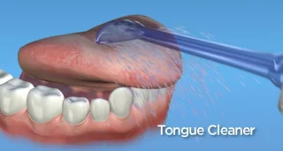 Waterpik Tongreinigingstips TC-70, 2 stuks