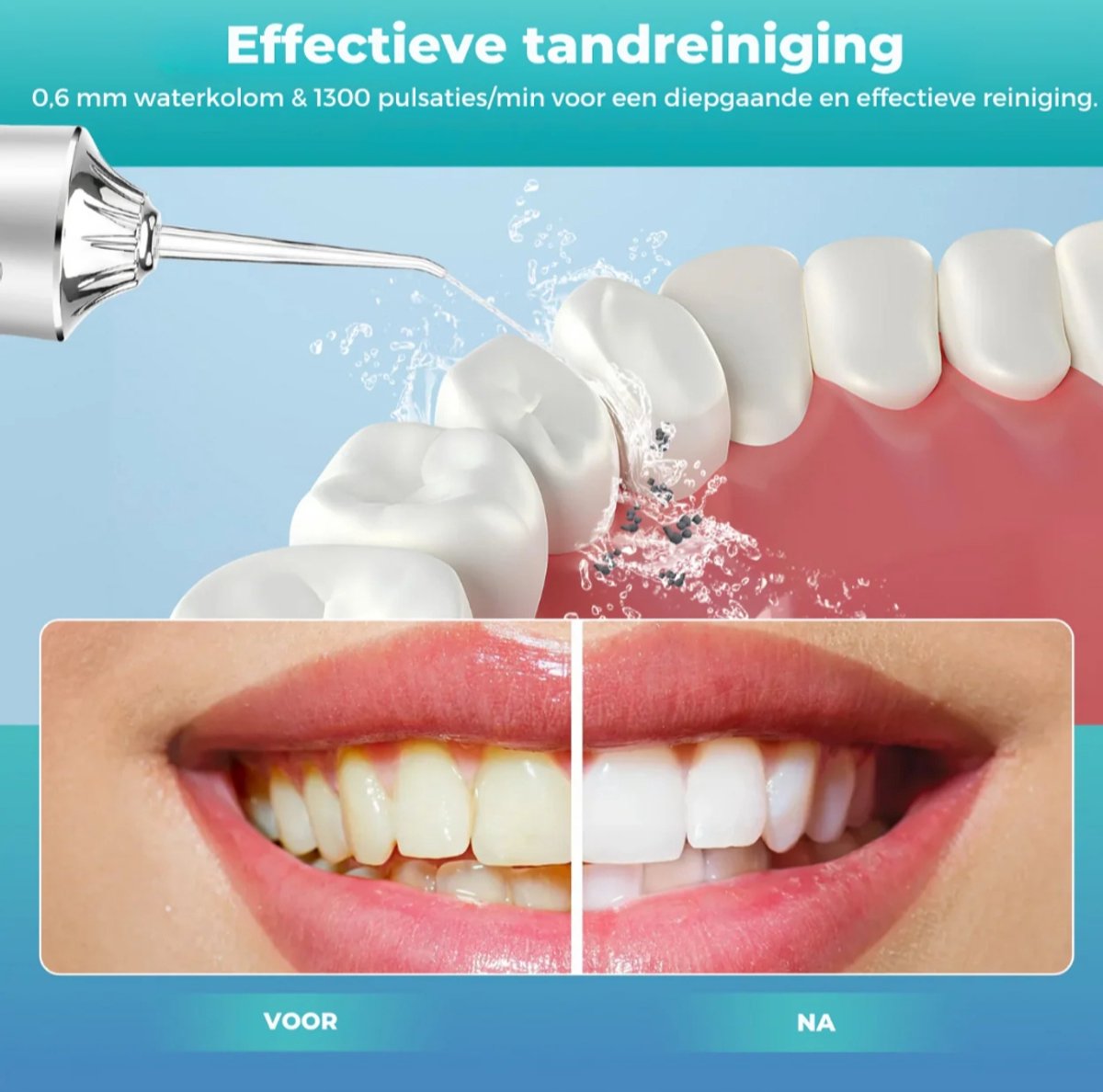 Wat vinden we goed aan de Waterpik Waterflosser Draadloos Groen
