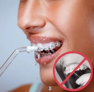 Waterpik Waterflosser Draadloos Groen