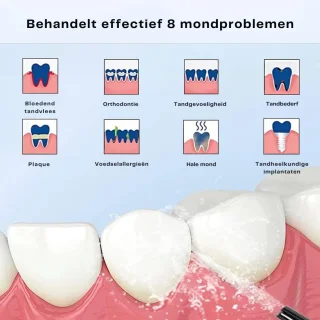 ZRSS Waterflosser Elektrisch Draadloos