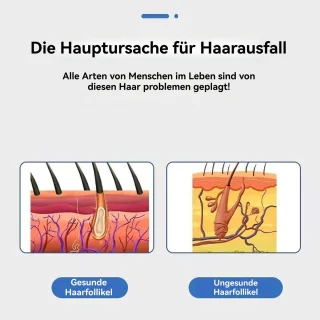 CHIWIN Hoofdmassager Elektrisch – Hoofdhuidmassage Borstel met 46 Massagepunten – 3 Trilmodes en Rood/Blauw Licht – Draagbaar USB Oplaadbaar – Voor Haarverzorging en Ontspanning