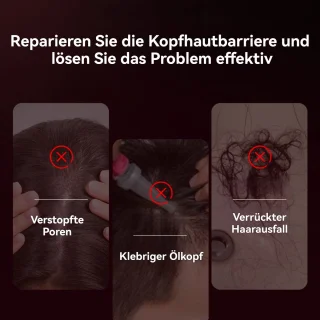 CHIWIN Hoofdmassager - Elektrische Massageborstel