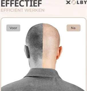 Xolby® 5 in-1 Multifunctionele 6D Scheerapparaat, Mannen + Extra Scheerkop - Gezicht en Hoofd Trimmer - Skull Shaver - Nat & Droog Shaver - Face en Head Shaver – Hoofd Kaal