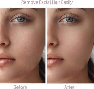 Elektrisch Gezicht Ontharen Apparaat voor Vrouwen - 2 Verwisselbare Opzetstukken - Geschikt voor Bovenlip en Kin - Draadloos en Zachte Huidvriendelijke Werking