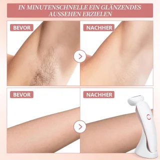 Ladyshave 3-in-1 Elektrisch Scheerapparaat Dames