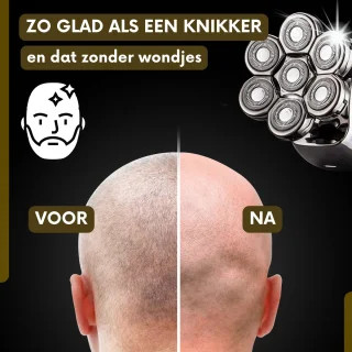 Sansbeauté SkullSharp PRO 6-in-1 Scheerapparaat met Trimmer en Extra Scheerkop