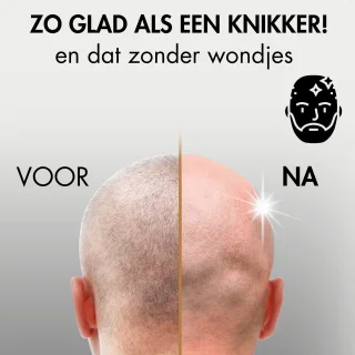 Sansbeauté SkullSharp PRO 6-in-1 Scheerapparaat voor Mannen