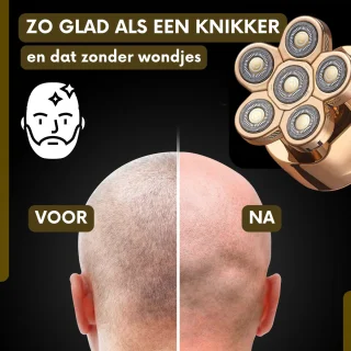 Sansbeauté SkullSharp V1 6-in-1 Scheerapparaat voor Mannen