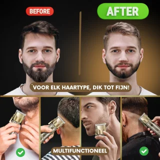 Professionele Draadloze Cheveux Haartrimmer voor Mannen